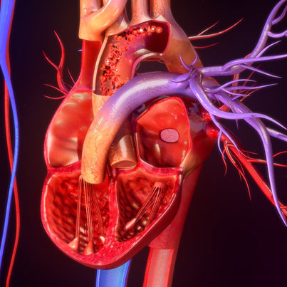 Medical Narration